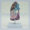 PNT-0732 Pathological model of bronchi pulmonary ,biological model
